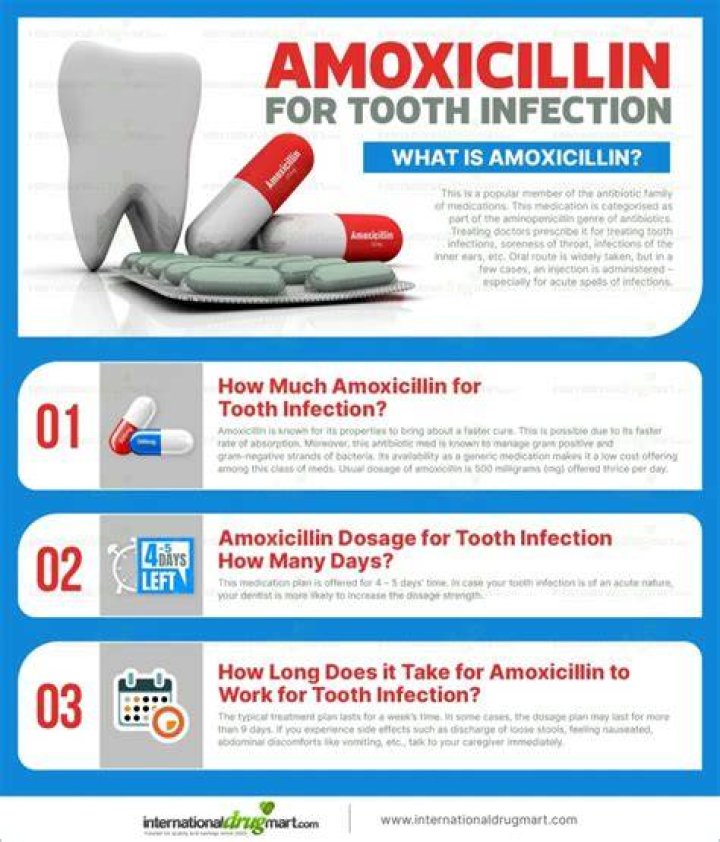Can AMOX CLAV treat tooth infection?