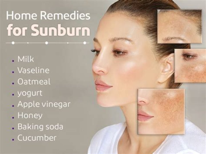 Can honey clear sunburn?