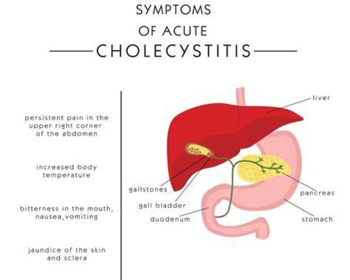 Is acute cholecystitis an emergency?