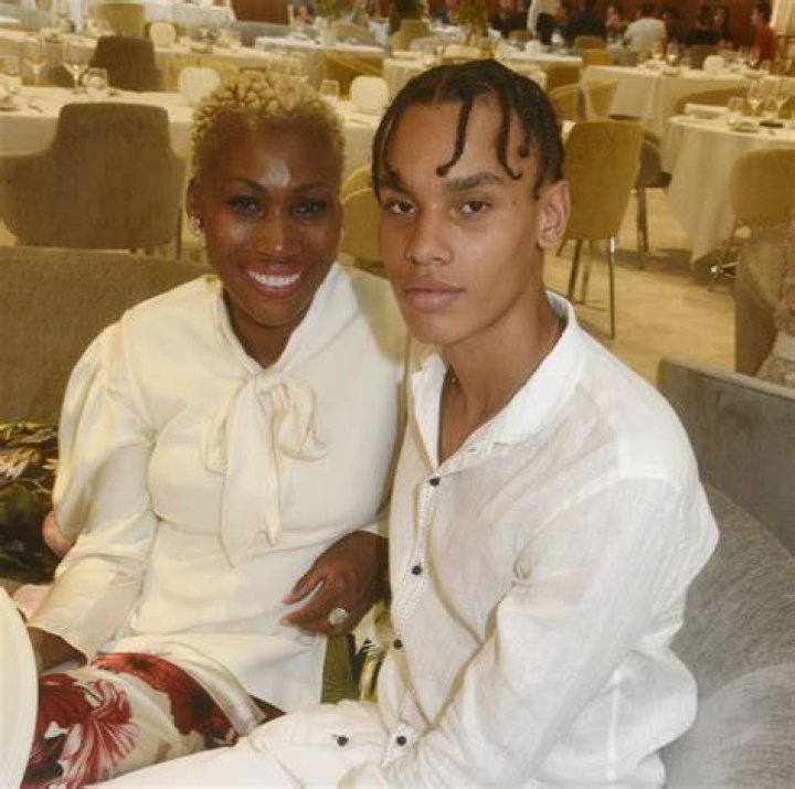 What deformity did Prince's son have?