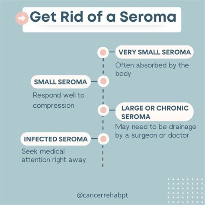Why does my seroma keep refilling?